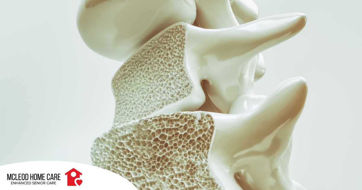 An image of a spine with the inside exposed represents osteoporosis.